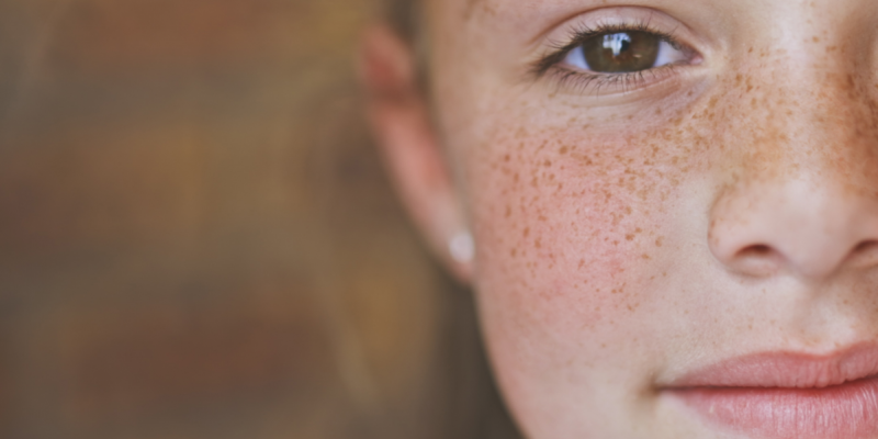 71_Obesità-nei-bambini