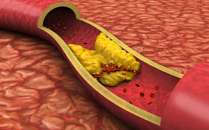 Scopri i benefici della dieta su misura per patologie croniche come diabete, colesterolo alto e intolleranze alimentari. Approccio nutrizionale personalizzato per migliorare la salute e prevenire complicazioni.