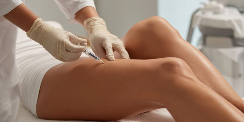 Medico esegue mesoterapia corporea per cellulite e adiposità localizzate a Milano