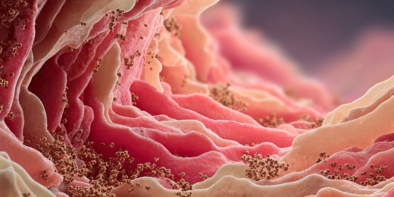 Disturbi intestinali cronici causati da accumulo di metalli pesanti nell'organismo