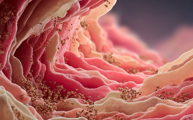 Disturbi intestinali cronici causati da accumulo di metalli pesanti nell'organismo